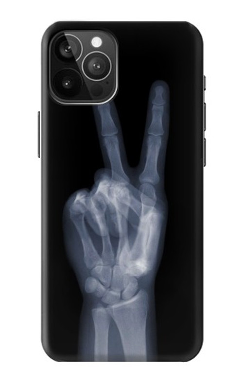 W3101 X-ray Peace Sign Fingers Case Cover Custodia e Flip Case per iPhone 12 Pro Max