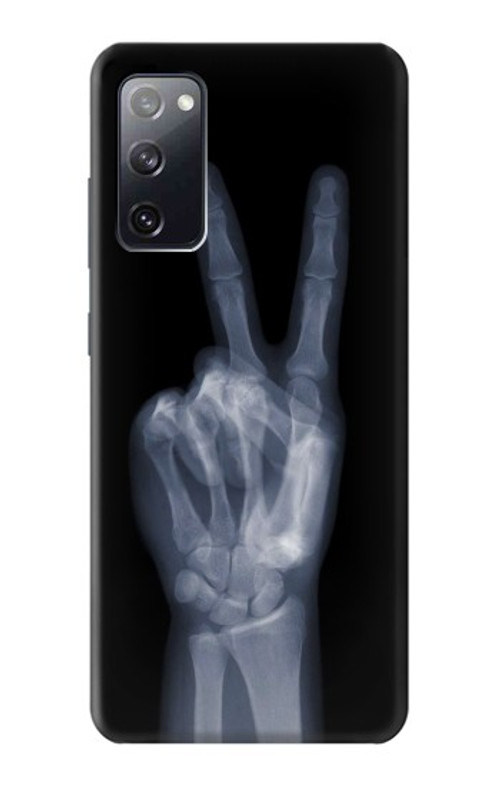 W3101 X-ray Peace Sign Fingers Case Cover Custodia e Flip Case per Samsung Galaxy S20 FE
