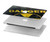 W3891 Nuclear Hazard Danger Case Cover Custodia per MacBook Pro 13″ - A1706, A1708, A1989, A2159, A2289, A2251, A2338