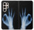 W3239 X-Ray Hand Sign OK Case Cover Custodia e Flip Case per Samsung Galaxy S24 Ultra