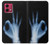 W3239 X-Ray Hand Sign OK Case Cover Custodia e Flip Case per Motorola Moto G84 W3239 X-Ray Hand Sign OK Case Cover Custodia e Flip Case per Motorola Moto G84