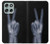 W3101 X-ray Peace Sign Fingers Case Cover Custodia e Flip Case per Motorola Moto G56