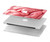 W0339 Brain Case Cover Custodia per MacBook Air 13″ - A1369, A1466