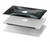 W1639 Gothic Corset Black Case Cover Custodia per MacBook Pro 13″ - A1706, A1708, A1989, A2159, A2289, A2251, A2338