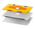 W2760 Yellow Duck Tuxedo Cartoon Case Cover Custodia per MacBook Pro 13″ - A1706, A1708, A1989, A2159, A2289, A2251, A2338