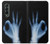 W3239 X-Ray Hand Sign OK Case Cover Custodia e Flip Case per Samsung Galaxy Z Fold 3 5G