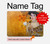 W3332 Gustav Klimt Adele Bloch Bauer Case Cover Custodia per MacBook Pro 14 M1,M2,M3 (2021,2023) - A2442, A2779, A2992, A2918