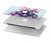 W3711 Pink Pineapple Case Cover Custodia per MacBook Pro 16 M1,M2,M3,M4 (2021,2024) - A3403, A3186, A2991, A2780, A2485