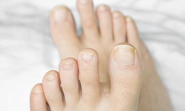 Strong Nails: What Your Toenails Say About Your Health