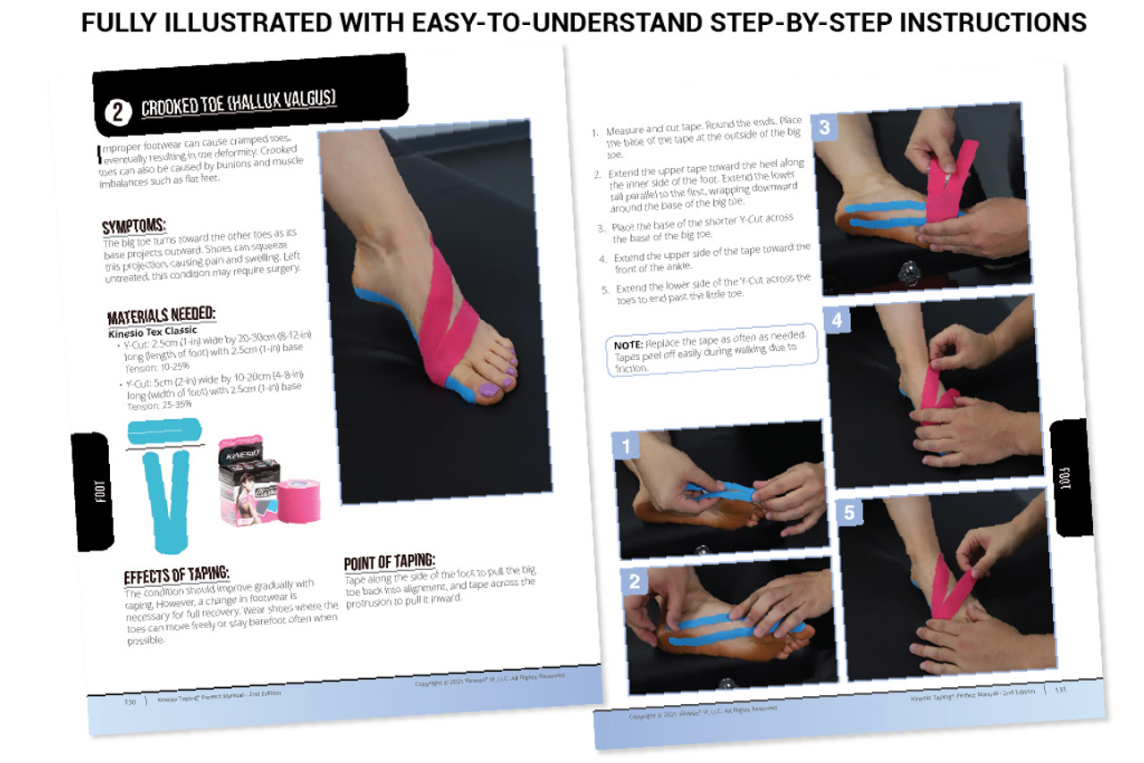 Kinesio Taping Perfect Manual - 2nd Edition
