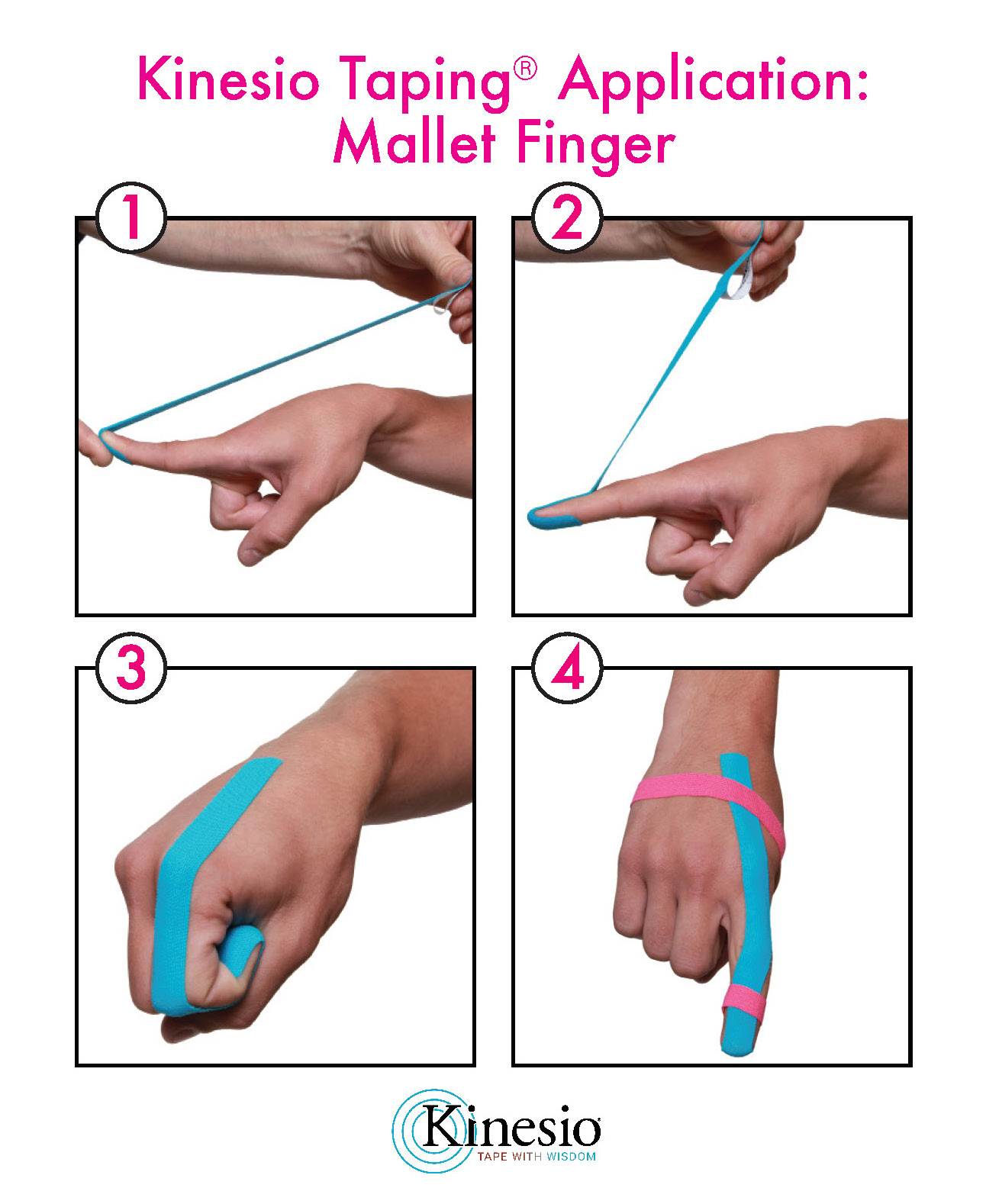 How to tape a sprained finger