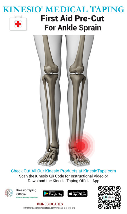 Kinesio Tex Tape used for high ankle sprain treatment of Oscar