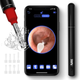 AIRE™ Ear Wax Removal Kit with 1080P FHD Wi-Fi Ear Camera product
