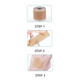 Multipurpose Silicone Scar Sheet for Scar Removal product