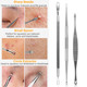 5-Piece Skincare Blackhead Remover Kit product