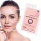 Invisible Hydrocolloid Acne Patches (96-Count) product