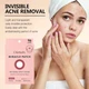 Invisible Hydrocolloid Acne Patches (96-Count) product