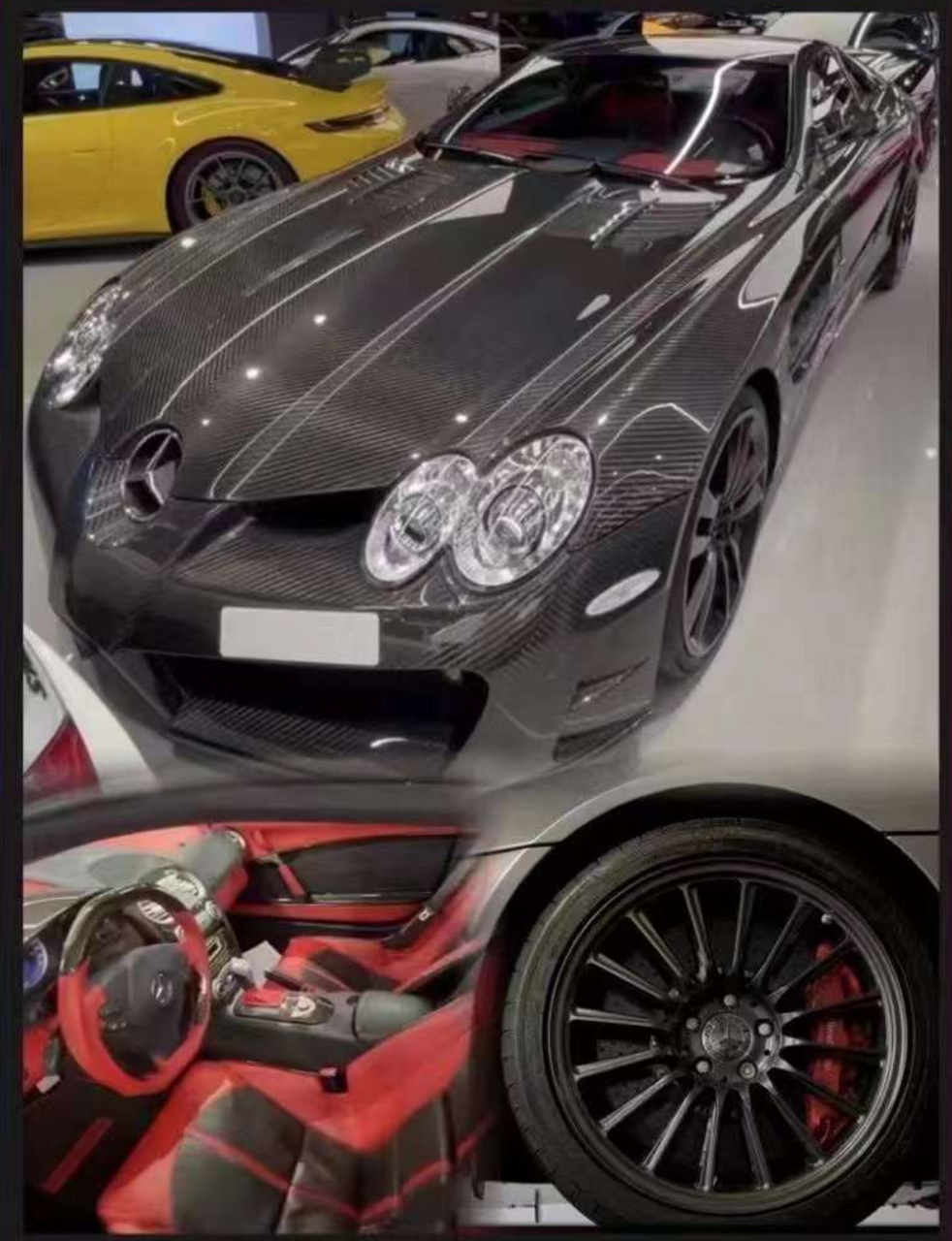 1/18 Frontiart Mercedes-Benz McLaren SLR (Full Carbon Black) Full Open Resin Car Model Limited 50 Pieces