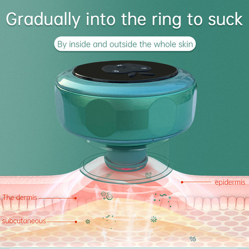 Smart Cupping Machine – Anti-Cellulite Vacuum Suction Massage Cup Set