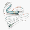 MAGIC 1.2F X 165CM LENGTH MICROCATHETER , 165cm, 1.2Fr x 0,21mm= 0.008"