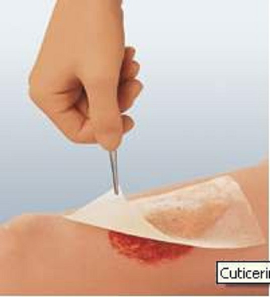 66045503, Impregnated Dressing Cuticerin 3 X 8 Inch Gauze Cuticerin, Case of 150