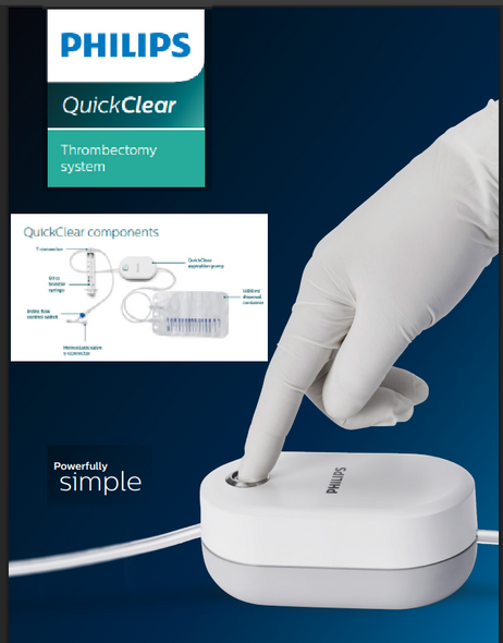 AC10SH085 QuickClear Mechanical thrombectomy system, 10Fr. x 85cm 0.111 inch 85 cm 102 cm Shaped 0.035 inch (with obturator) venous. Box of 01