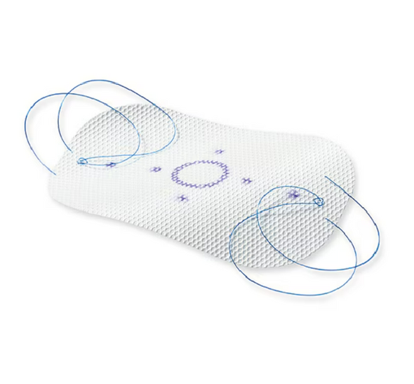 Medtronic PPDS3530 Parietene™ DS Composite Mesh, 35cm X 30 cm, Macroporous Polypropylene Absorbable mesh, Hernia Repair, Box of 01