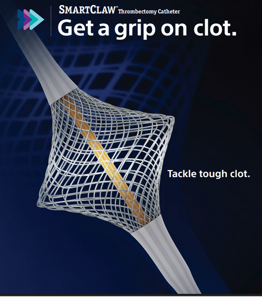 Boston Scientific FD0660-01 SmartClaw™ Thrombectomy Catheter, 8 Fr, 20.0 mm X 145 cm length, 0.035” compatible guidewire, Box of 01