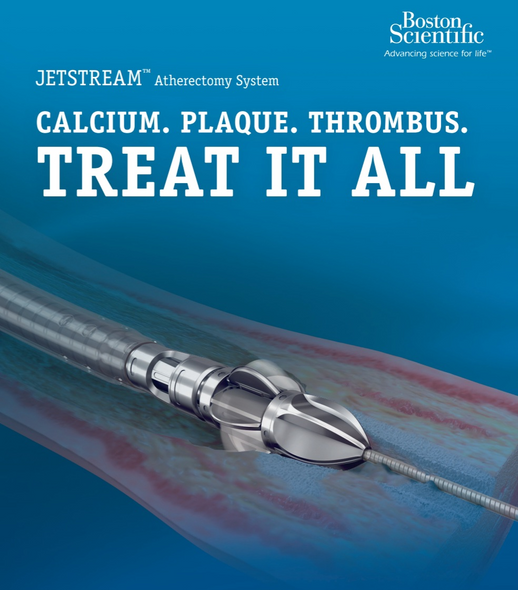 Boston Scientific 112262-001 Jetstream™ SC Atherectomy Catheter, 7 Fr 1.85mm X 145 cm length, 0.014” Max Guidewire Diameter, Box of 01  (PV3116F)