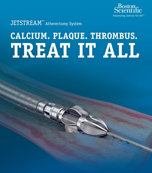 Boston Scientific 112264-001 Jetstream™ XC Atherectomy Catheter, 7 Fr 2.1/3.0 mm X 135 cm length, 0.014” Max Guidewire Diameter, Box of 01  (PV31300)