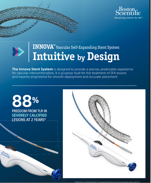 Boston Scientific, H74939293051030 Innova 39293-05103 Vascular Self-Expanding Stent System, 5mm x 100mm x 130cm, Box of 01