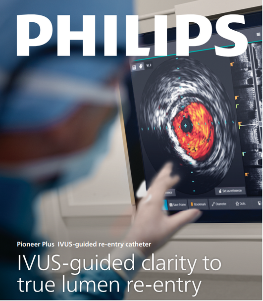 Philips PPLUS120 Pioneer Plus Catheter, IVUS-guided re-entry catheter 6Fr, 014" X 120cm, Box of 01