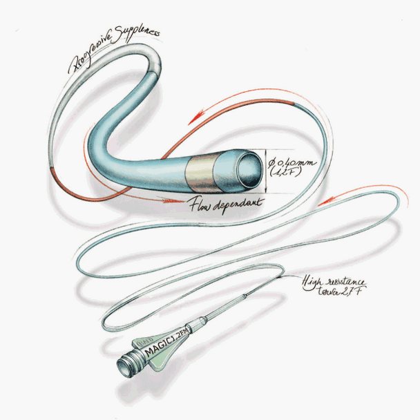MAGIC 1.2F X 165CM LENGTH MICROCATHETER , 165cm, 1.2Fr x 0,21mm= 0.008"