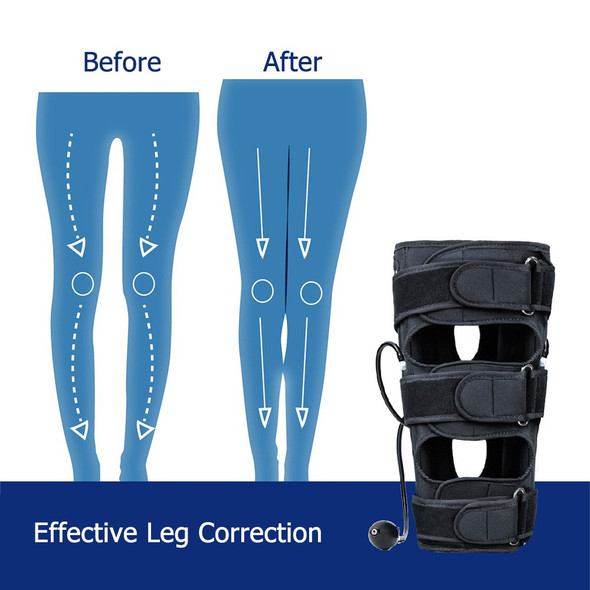 10296 O / X Type Legs Corrector Band for Adults Bowed Legs Knee Valgum Straightening Air Pressure Posture Corrector Beauty Leg Band