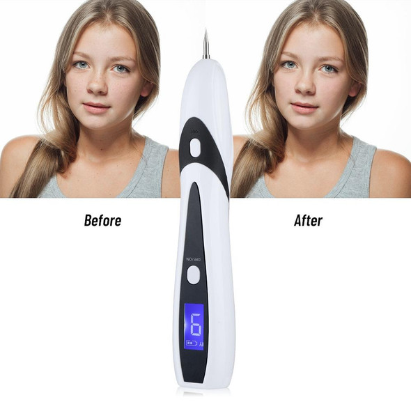 Blue Light Mole Removal Pen 9-speed LCD Display Spot Removal Pen(White)