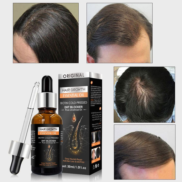 Biotin Hair Growth Oil