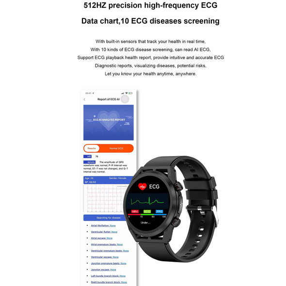 ET310 1.39 inch IPS Screen IP67 Waterproof Silicone Band Smart Watch, Support Body Temperature Monitoring / ECG (Dark Blue)