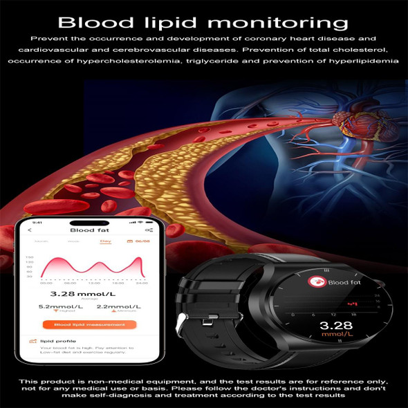 ET340 1.46 inch Color Screen Smart Leatherette Strap Watch,Support Blood Oxygen / Blood Glucose / Uric Acid Measurement / Blood Lipid Monitoring(Brown)