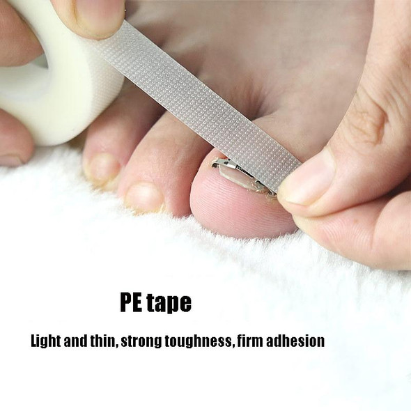 Orthopedic Buckle Toe Nail Groove Ingrown Nail Corrector, Style:No. 42, Specifications:Positive Nail Buckle