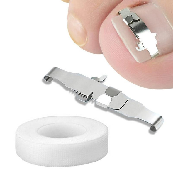 Orthopedic Buckle Toe Nail Groove Ingrown Nail Corrector, Style:No. 36, Specifications:Positive Nail Buckle