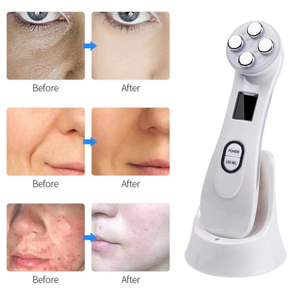 Radio Mesotherapy Electroporation Face Beauty Pen Radio Frequency LED Photon Face Skin Rejuvenation Remover Wrinkle(Pearl White)