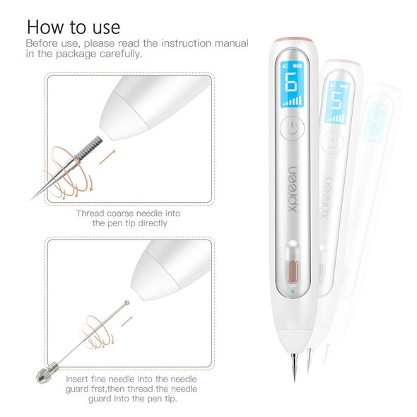 XPREEN XPRE051 Professional Wireless Rechargeable Mole Freckle Dark Spots Tattoo Wart Removal Pen Skin Tag Spot Eraser Pro Beauty Sweep Spot Pen Kit With LED Screen & Spotlight(White)