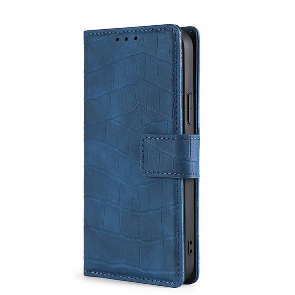 For OPPO Realme 8i Skin Feel Crocodile Magnetic Clasp Leatherette Phone Case(Blue)