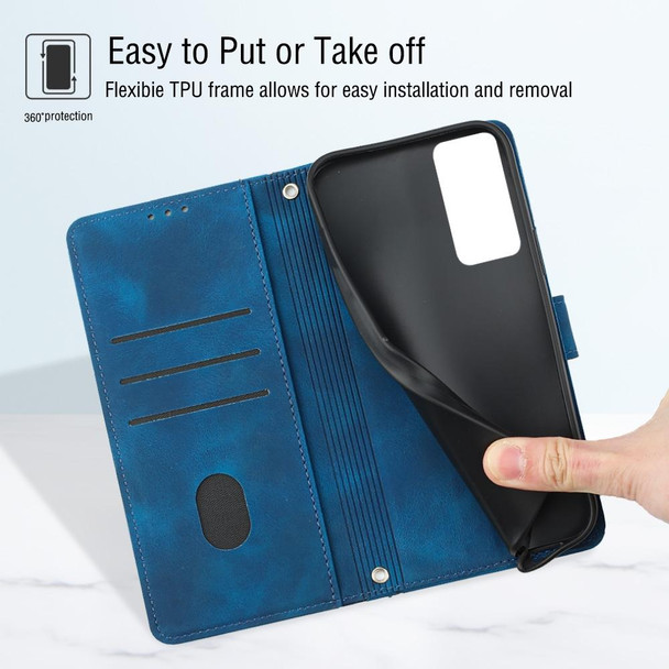 For Tecno Camon 18 / 18 P Skin-feel Embossed Leatherette Phone Case(Blue)