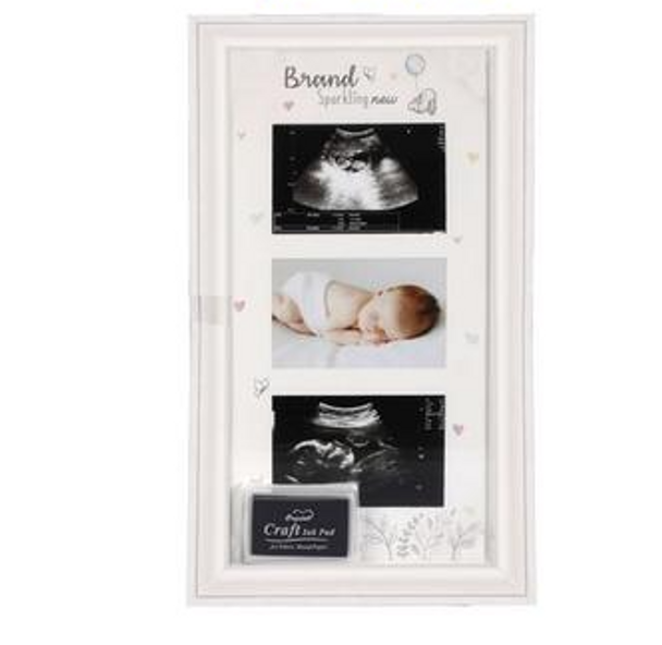 Baby Scan Picture Frame