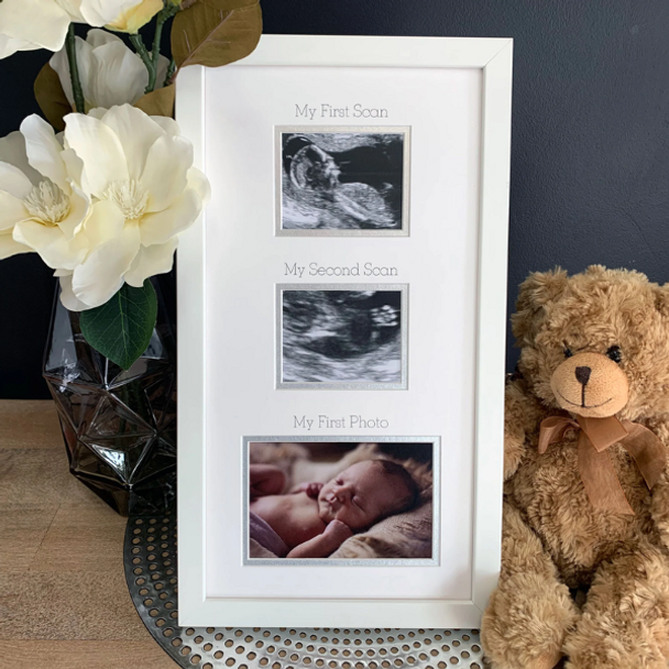 Baby Scan Picture Frame