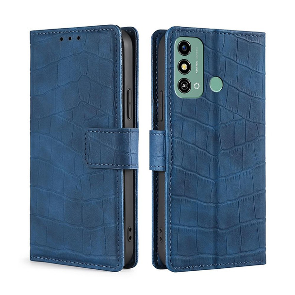 For ZTE Blade A53 4G Skin Feel Crocodile Magnetic Clasp Leather Phone Case(Blue)