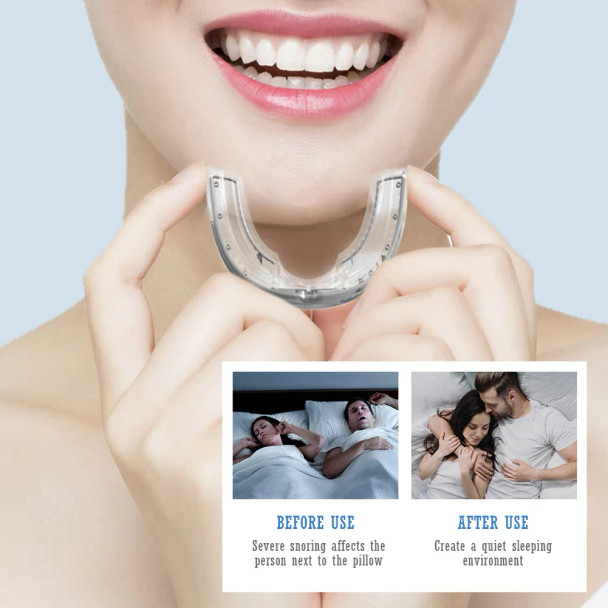 Anti-Snoring Device