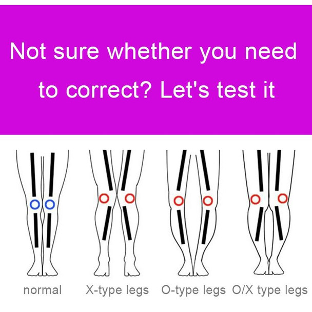 3 PCS/Set Leg Posture Corrector O/X-type Bowlegs Orthotic Bandage Straightening Belt Band, Size: M(Purple)