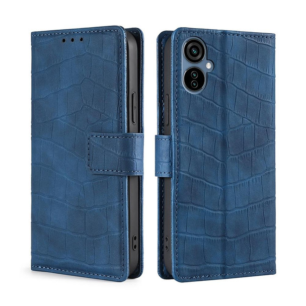 For Tecno Camon 19 Neo Skin Feel Crocodile Magnetic Clasp Leatherette Phone Case(Blue)